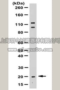 merck millipore,默克密理博,07-2151,Anti-Rac3 Antibody merck millipore,默克密理博,07-2151,Anti-Rac3 Antibody