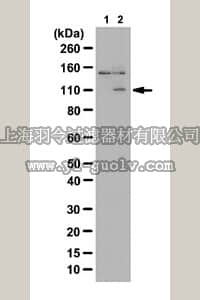 merck millipore,默克密理博,07-2177,Anti-phospho-PKD2 Antibody (Ser197/Ser200)
