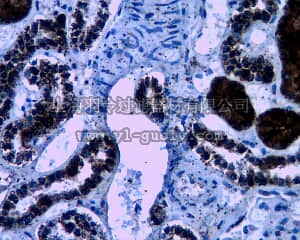 merck millipore,默克密理博,07-2270,Anti-WNK4 Antibody