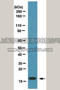 merck millipore,默克密理博,07-2274,Anti-FSP1/S100A4 Antibody