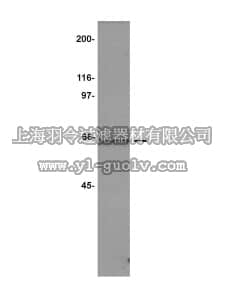 merck millipore,默克密理博,07-228,Anti-TACC2 Antibody merck millipore,默克密理博,07-228,Anti-TACC2 Antibody