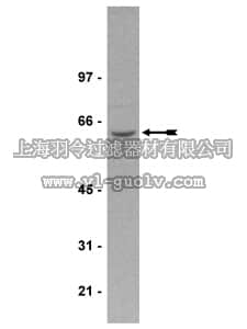 merck millipore,默克密理博,07-250,Anti-PP2A Antibody, A subunit