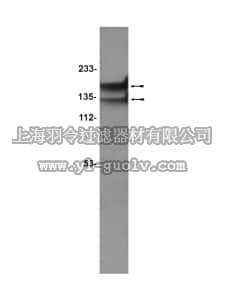 merck millipore,默克密理博,07-259,Anti-δ-Catenin Antibody merck millipore,默克密理博,07-259,Anti-δ-Catenin Antibody