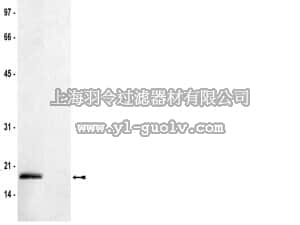 merck millipore,默克密理博,07-274,Anti-dimethyl-Histone H3 (Lys36) Antibody