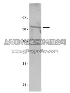 merck millipore,默克密理博,07-318,Anti-TBX2 Antibody