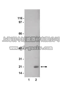 merck millipore,默克密理博,07-326,Anti-phospho-Cofilin 2 (Ser3) Antibody