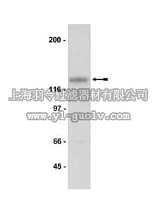 merck millipore,默克密理博,07-356,Anti-NR3A Antibody merck millipore,默克密理博,07-356,Anti-NR3A Antibody
