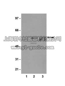 merck millipore,默克密理博,07-359,Anti-Estrogen Receptor β Antibody, CT