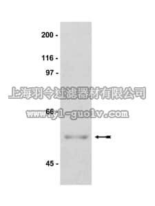 merck millipore,默克密理博,07-372,Anti-Akt2/PKBβ Antibody
