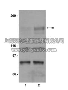 merck millipore,默克密理博,07-374,Anti-phospho-KDR/Flk-1/VEGFR2 (Tyr1214) Antibody