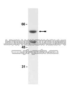merck millipore,默克密理博,07-383,Anti-Akt3/PKBγ Antibody