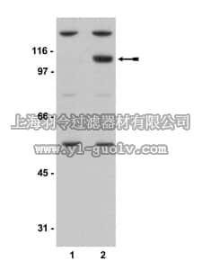 merck millipore,默克密理博,07-385,Anti-phospho-PKD2 (Ser876) Antibody