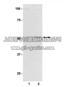 merck millipore,默克密理博,07-393,Anti-phospho-GSK3α (Ser21) Antibody