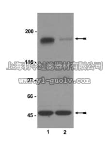 merck millipore,默克密理博,07-398,Anti-phospho-NR2B (Ser1303) Antibody
