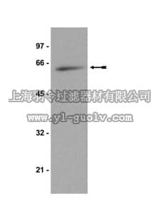 merck millipore,默克密理博,07-402,Anti-p70 S6 Kinase Antibody