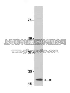 merck millipore,默克密理博,07-403,Anti-Cu/Zn-SOD Antibody