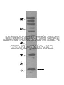 merck millipore,默克密理博,07-413,Anti-dimethyl-Arginine Antibody, symmetric (SYM11)