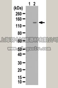 merck millipore,默克密理博,07-428-I,Anti-phospho eNOS Antibody (Ser1177)