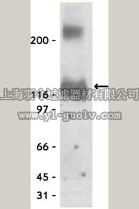 merck millipore,默克密理博,07-432,Anti-K+/Cl- Cotransporter (KCC2) Antibody