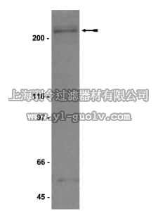 merck millipore,默克密理博,07-434,Anti-BRCA1 Antibody