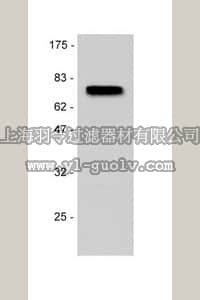merck millipore,默克密理博,07-476,Anti-p75NTR (Neurotrophin Receptor) Antibody