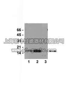 merck millipore,默克密理博,07-593,Anti-acetyl-Histone H3 (Lys9/18) Antibody