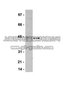 merck millipore,默克密理博,07-601,Anti-TTF-1 Antibody
