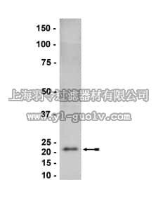merck millipore,默克密理博,07-604,Anti-Rac2 Antibody