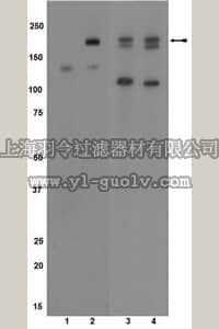 merck millipore,默克密理博,07-722,Anti-phospho-VEGFR2/Flk-1/KDR (Tyr1054) Antibody