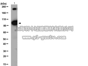 merck millipore,默克密理博,07-724,Anti-α-Insulin Receptor Antibody, β subunit