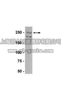 merck millipore,默克密理博,07-730,Anti-Neurofibromin (NF-1) Antibody