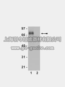 merck millipore,默克密理博,07-758,Anti-phospho-Flt-1 (Tyr1213) Antibody