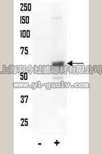 merck millipore,默克密理博,07-789,Anti-phospho-AKT (Thr34) Antibody