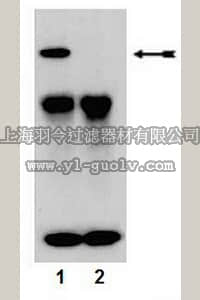 merck millipore,默克密理博,07-790,Anti-phospho-PKCα (Ser657/Tyr658) Antibody