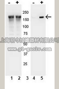 merck millipore,默克密理博,07-819,Anti-phospho-EGFR (Tyr1148) Antibody