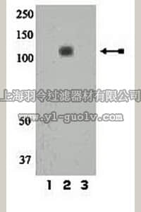 merck millipore,默克密理博,07-839,Anti-phospho-IR/IGF1R (Tyr1158) Antibody