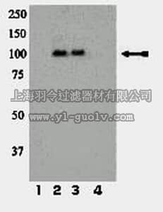 merck millipore,默克密理博,07-841,Anti-phospho-IR/IGF1R (Tyr1158/Tyr1162/Tyr1163) Antibody