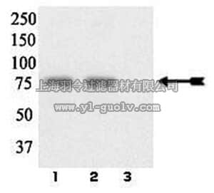 merck millipore,默克密理博,07-850,Anti-phospho-LIMK 1/2 (Tyr507/Thr508) Antibody