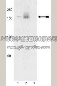 merck millipore,默克密理博,07-861,Anti-phospho-PDGFRα (Tyr742) Antibody