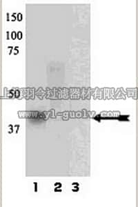 merck millipore,默克密理博,07-867,Anti-phospho-PKA catalytic subunits α/β (Thr197) Antibody
