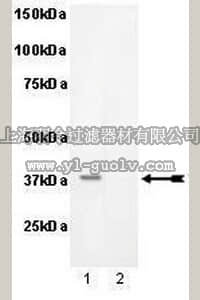 merck millipore,默克密理博,07-868,Anti-phospho-PKA Catalytic β subunit (Ser338) Antibody