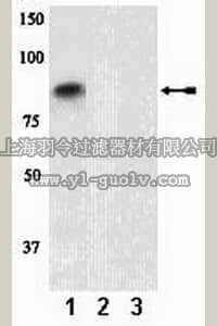 merck millipore,默克密理博,07-870,Anti-phospho-PKCβ I&II (Thr500) Antibody