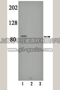 merck millipore,默克密理博,07-879,Anti-phospho-PKCγ (Thr655) Antibody