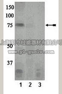 merck millipore,默克密理博,07-883,Anti-phospho-PKCθ (Ser676) Antibody