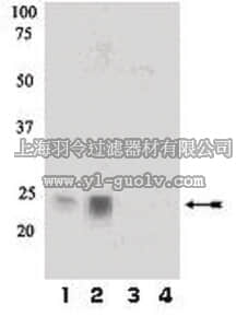 merck millipore,默克密理博,07-896,Anti-phospho-Rac1/cdc42 (Ser71) Antibody