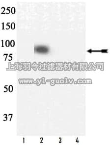 merck millipore,默克密理博,07-915,Anti-phospho-Syk (Tyr323) Antibody