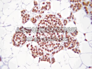 merck millipore,默克密理博,07-962,Anti-phospho-Estrogen Receptor α (Ser305) Antibody