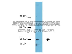merck millipore,默克密理博,09-037,Anti-acetyl C/EBPβ Antibody (Lys215, Lys216)