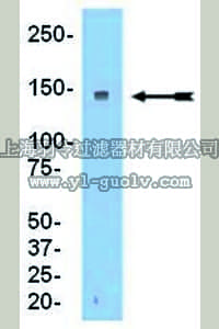 merck millipore,默克密理博,09-094,Anti-RFC1 Antibody merck millipore,默克密理博,09-094,Anti-RFC1 Antibody