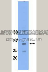 merck millipore,默克密理博,09-119,Anti-Isoprenylcysteine Carboxymethyl Transferase (ICMT) Antibody